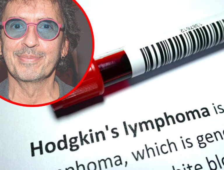 ¿Qué es el linfoma de Hodgkin?, Memo del Bosque murió de este cáncer