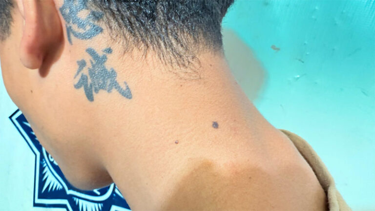 Municipales detienen a adolescente que será investigado por su presunta participación de un evento de dos lesionados por arma de fuego en Riveras del Bravo