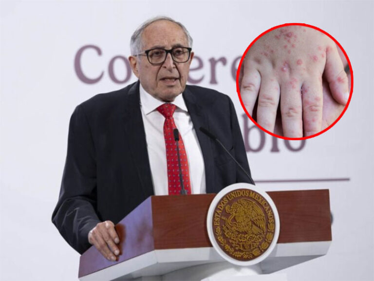 Sarampión en Chihuahua está contenido: Kershenobich
